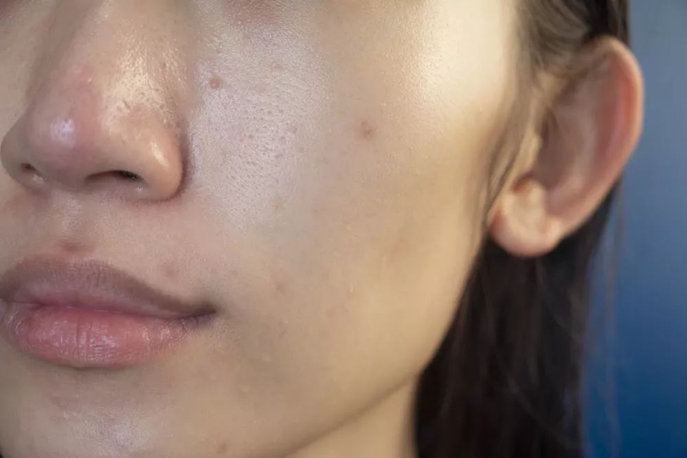 面霜推荐原来它才是干皮亲妈,有被称为干皮亲妈的面霜推荐吗