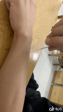 飞经走气手法视频,飞经走气针灸手法