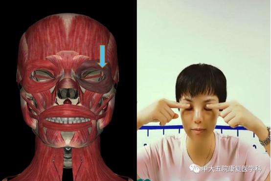 面瘫临床表现的科普视频,科普面瘫多久治疗效果最好