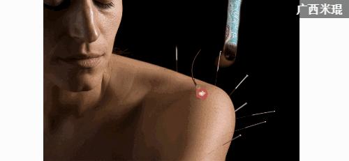 骨科专家教你护好关节,骨科专家孙好一招缓解关节损伤