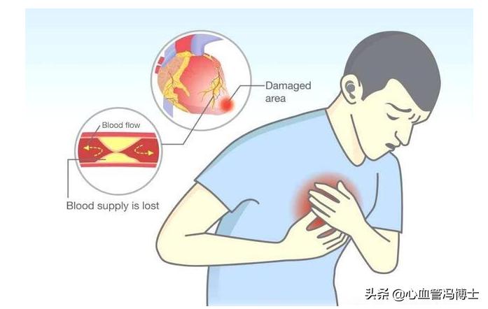 速效救心丸和丹参滴丸哪个功效好,速效救心丸和丹参滴丸哪个更好用