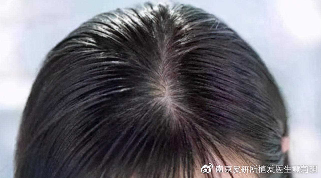 怎么让头发变得又黑又亮有光泽,如何保养头发让头发又黑又浓