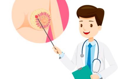 需要放疗的病人是不是就是晚期了,即将放疗的患者你需要了解什么