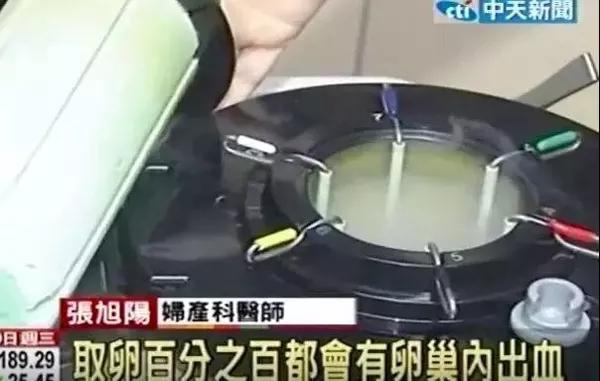 拜金的代价,花季少女堕落史!揭开捐卵黑中介的阴谋