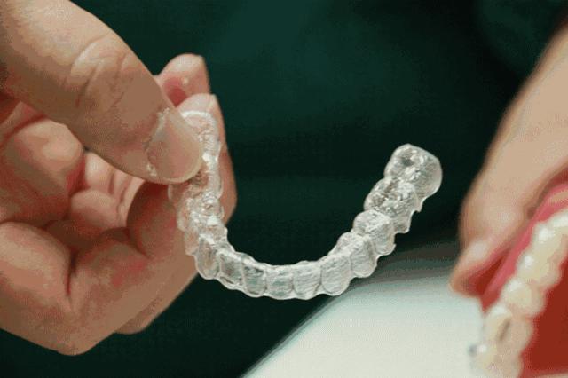 全隐形牙套矫正牙齿大概多少钱,隐形牙套咋改善脸型