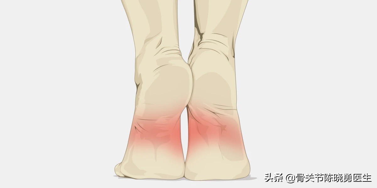 足弓处肿胀疼痛怎么办,内侧足弓疼痛是什么原因