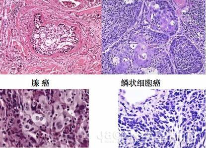 辟谣医生手术时捶打患者,辟谣手术