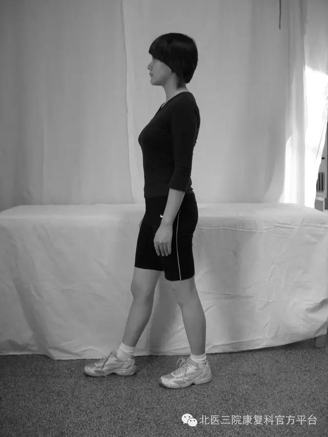 髋关节撞击综合征微创手术恢复,关节镜微创术半月板修复后康复