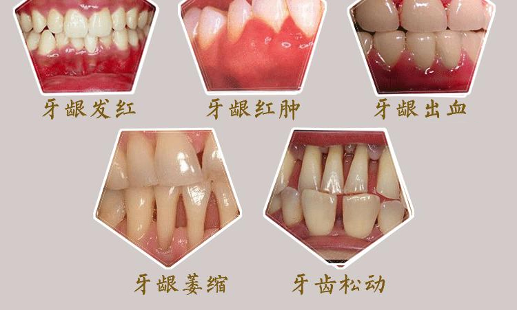 警惕年轻人,老掉牙真的不可避免吗