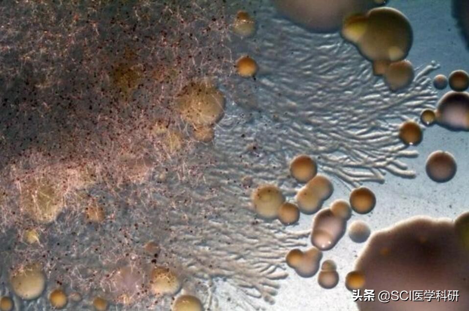 人为什么会长头皮屑简单的回答,头皮屑是什么细胞产生的