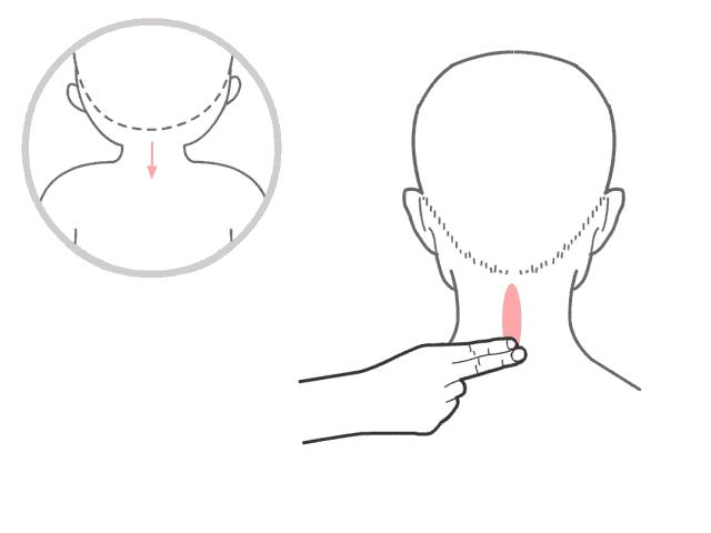急性肠胃炎38.3要喝退烧药吗,急性肠胃炎引起发烧吃什么退烧药