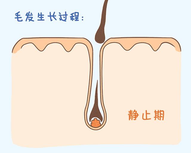 产后脱发怎么办最快最有效,产后脱发怎么办最有效的办法