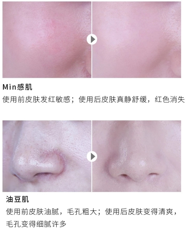 如果你还在为皮肤问题烦恼吗 (你还在为你的皮肤问题烦恼吗)