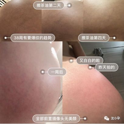 金牌月嫂推荐超实用母婴好物,金牌月嫂整理的40条笔记