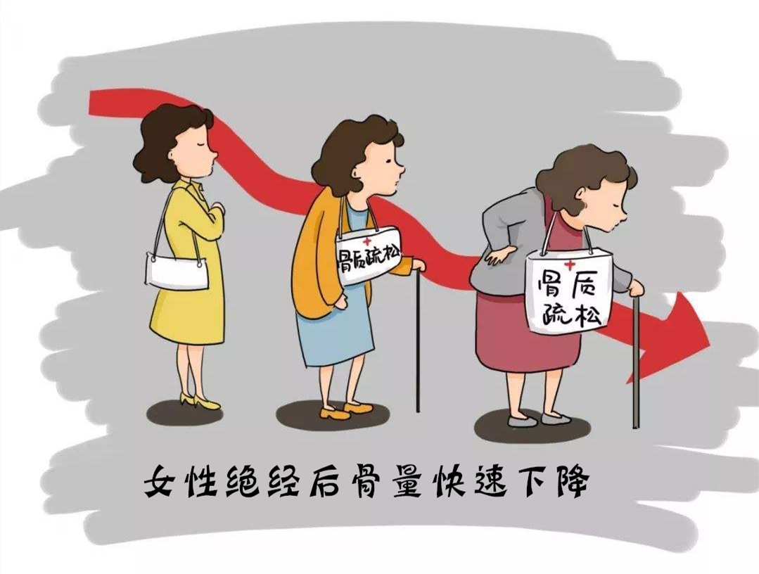 女性雌激素不足骨质疏松,老年女性骨质疏松能吃点雌激素吗