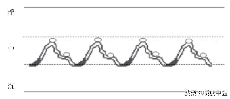 滑脉可不只是提示怀孕的喜脉