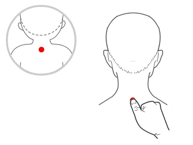 小孩发热灸大椎穴有什么好处,大椎穴治风寒感冒咳嗽吗