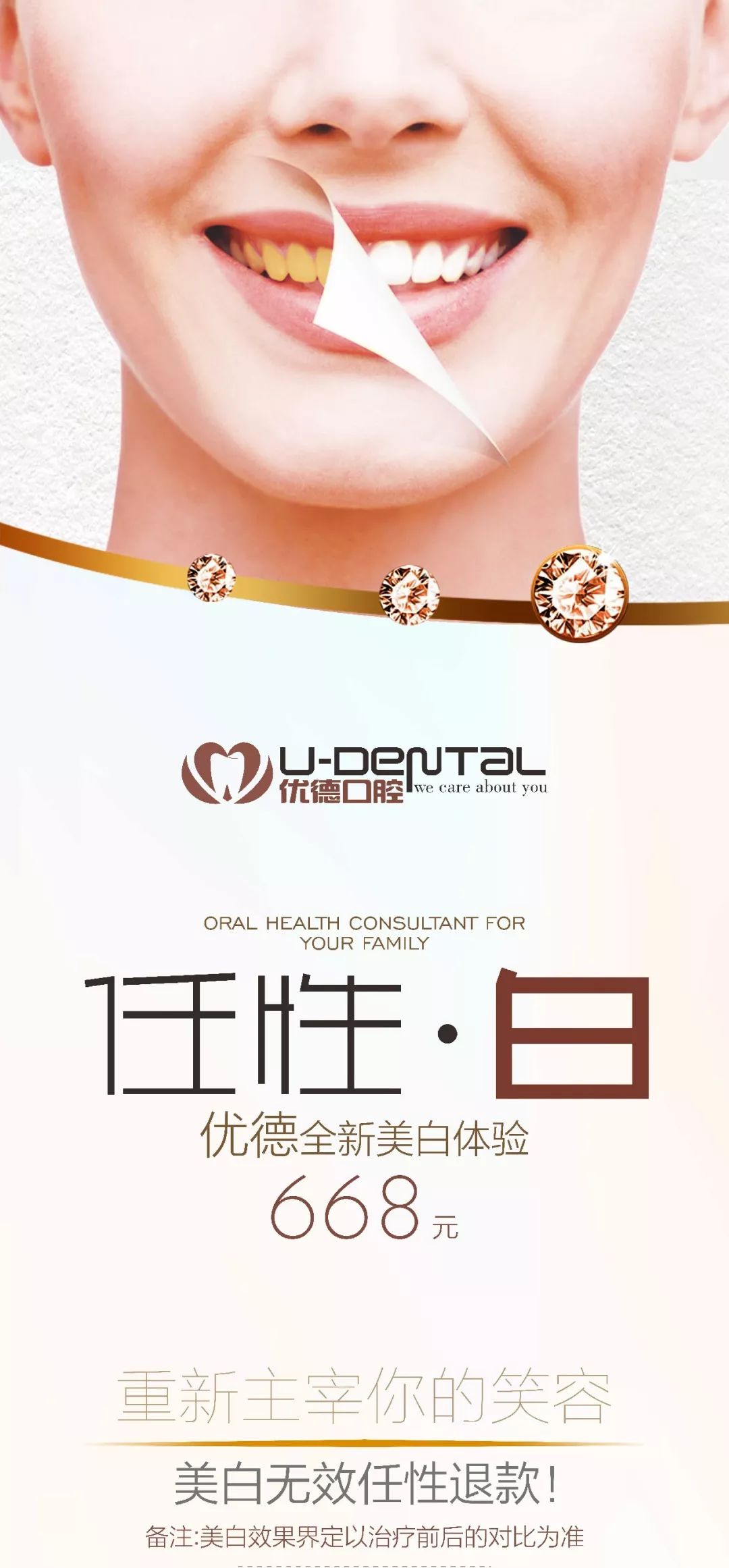 双十一美牙全瓷贴片活动,双十一美牙特惠