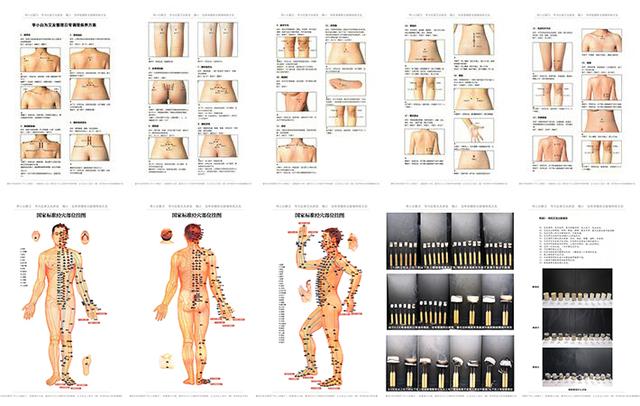 慢性胃炎艾灸灸什么穴位,慢性胃炎胃寒艾灸穴位