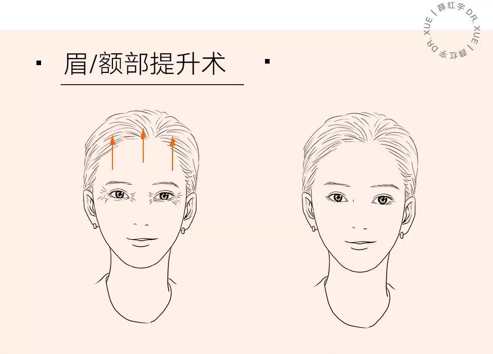 眼部抗衰最好方法,眼部抗衰效果图