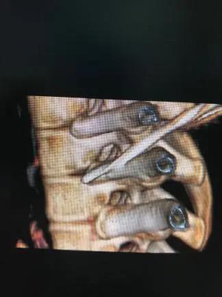 手汗症中医诊疗方案,手掌多汗症怎么治疗