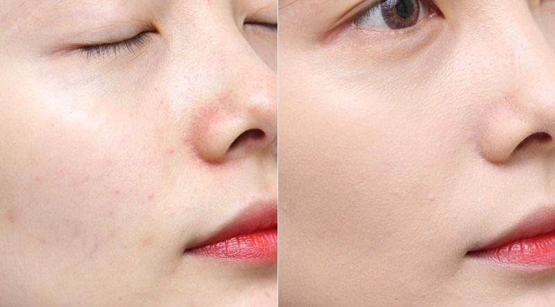 iope亦博气垫改名了么,iope亦博气垫适合什么皮肤