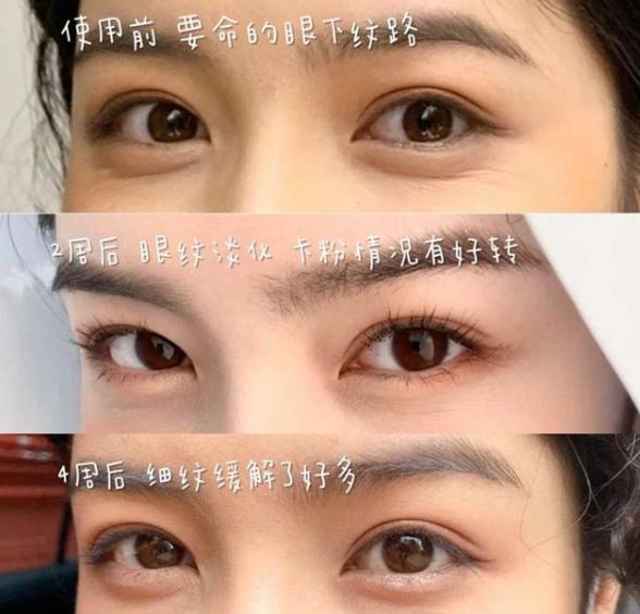 被称为“眼部橡皮擦”，消除除皱纹、淡化黑眼圈，熬夜*党**的福音