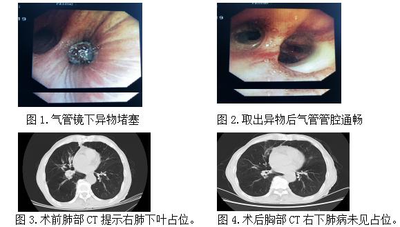 三亚人民医院呼吸内科在几楼,海南省人民医院呼吸内科