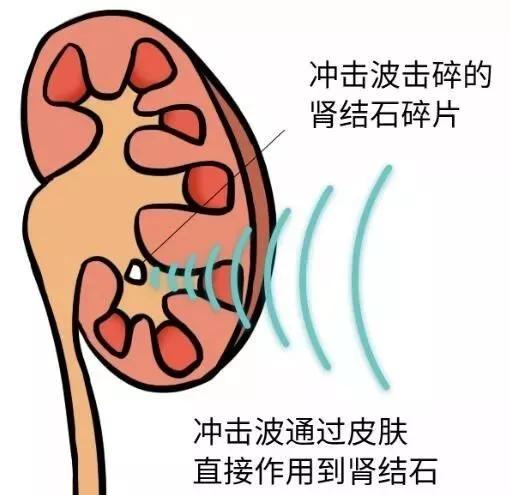 泌尿外科是指哪方面,泌尿外科都是些什么病人