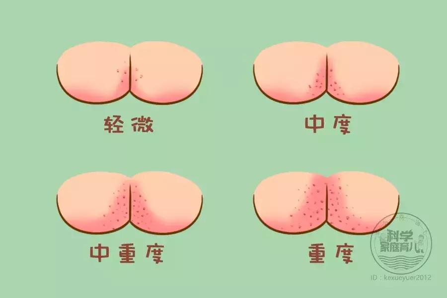 妈妈，痒、疼……6大*处私**问题离娃不远！一出生就要警惕！