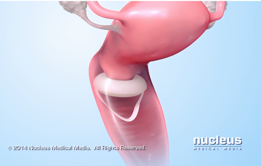 吃了避孕药后一个月内怀孕几率,吃了避孕药性激素对胎儿有影响吗