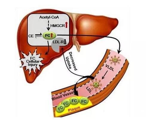 乙肝脸色发黄喝什么去黄,乙肝脸色发黄是怎么回事