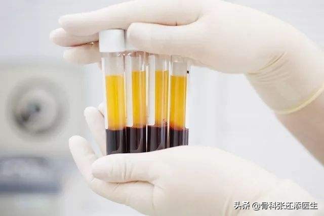 再生修复PRP是神物吗，是否存在夸大营销？骨科医生告诉你