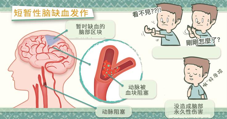 心脑短暂缺血,心肌缺血怎么调理能彻底治愈