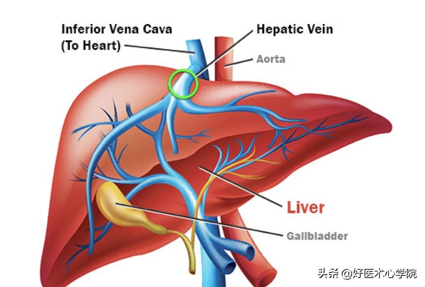 最常见的血栓类型是,最致命血栓视频