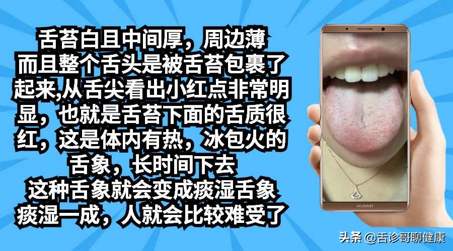 舌诊歌舌象分析及感悟,舌诊哥肝郁脾虚