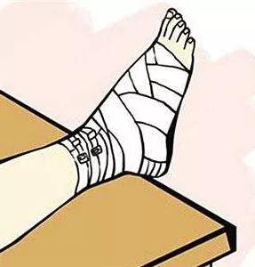 崴脚内踝扭伤,踝关节扭伤是脚崴吗