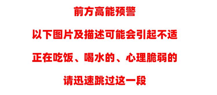 排油丸「奥利司他」让你瘦成闪电？真相没那么简单