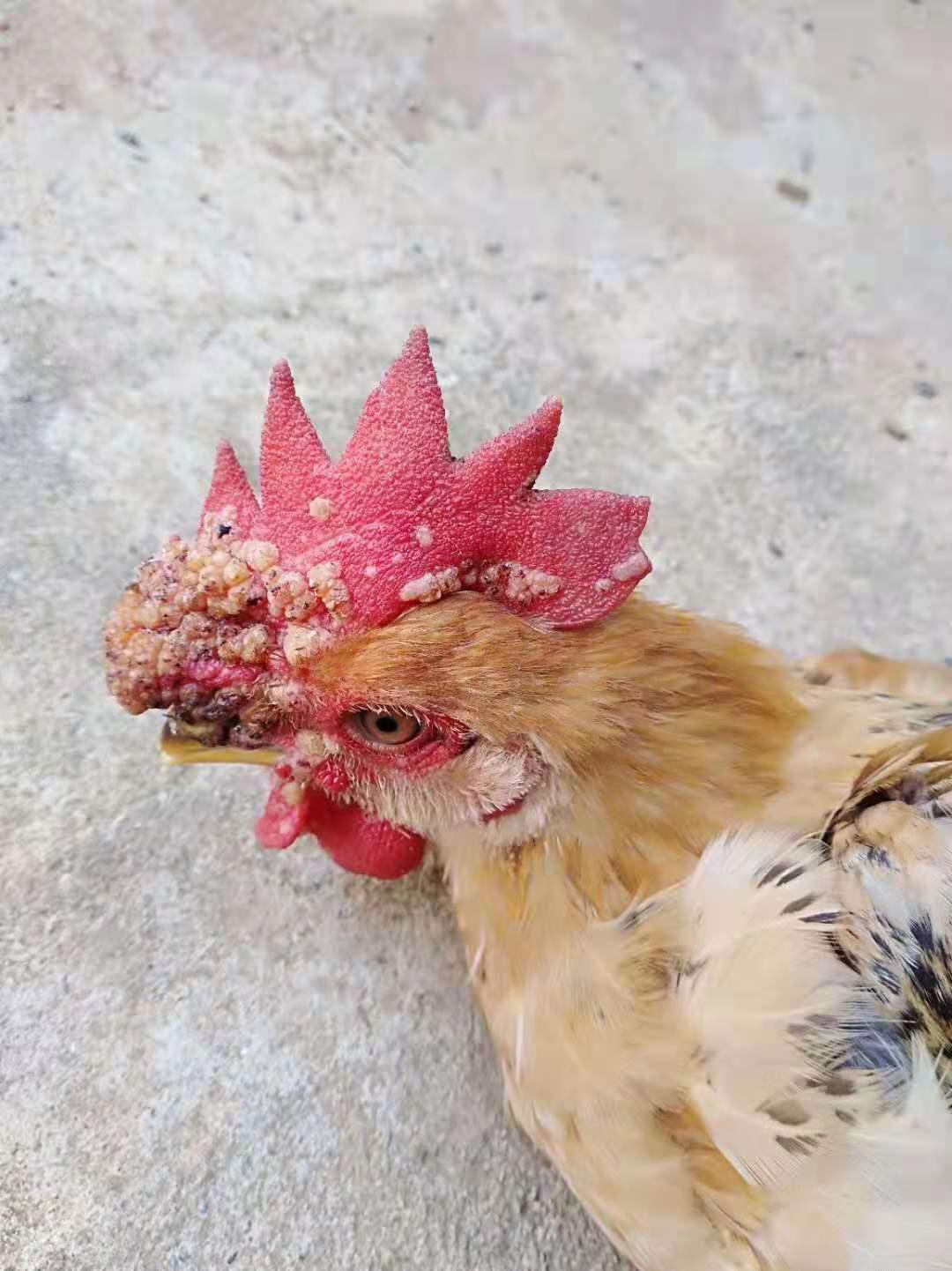 霉菌性炎症治疗经验,霉菌感染怎么治疗医问医答