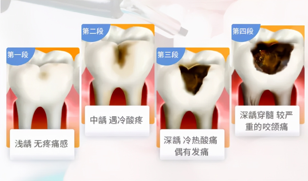 关注口腔健康从爱牙开始,关注口腔