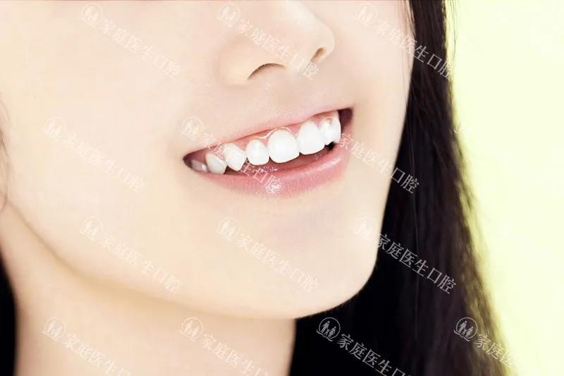 矫正牙齿详细流程,矫正牙齿所有阶段的步骤