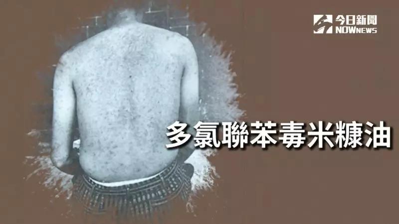 毒性最强的食物排行榜,营养专家公布了12种有毒的食物