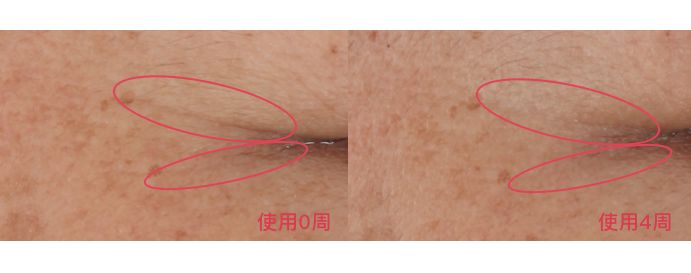 雅诗兰黛最新评测,雅诗兰黛精华测评连续剧