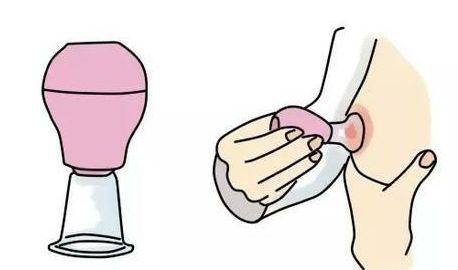 孕妇怀孕期乳房会越来越大,孕妇怀孕初期胸部有什么变化