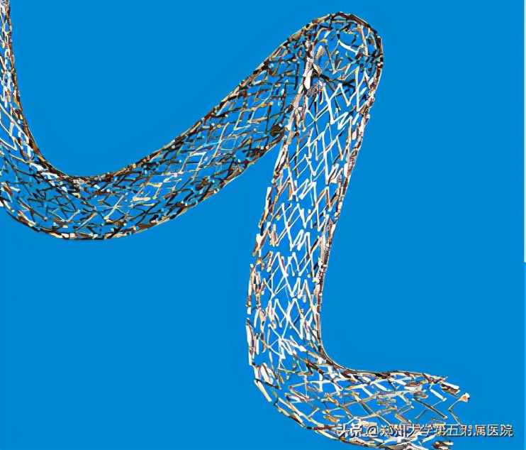 腿上放支架的风险和副作用,腿上放了钢板拿出来有后遗症吗