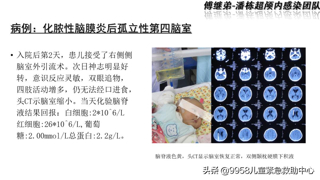 颅内感染康复治疗知识,小儿颅内感染的健康宣教