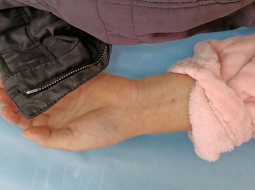 脑梗偏瘫失语怎么可以说话,脑梗失语康复操完整版