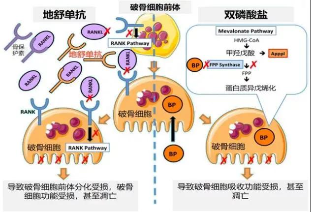 恶性肿瘤骨转移可以靶向治疗吗,靶向治疗骨转移成功案例