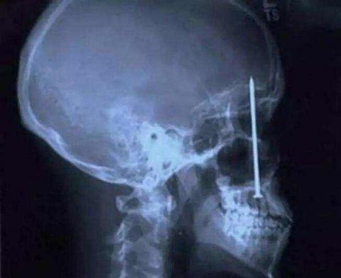 不作死就不会死看看你中了几条,不作死就不会死让人看的头皮发麻