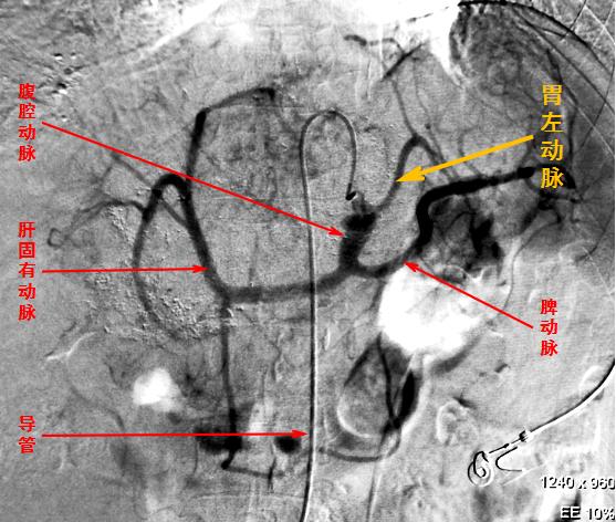 饥渴难耐却吞咽不下？吃货吃得停不下来？两个极端都可考虑请介入